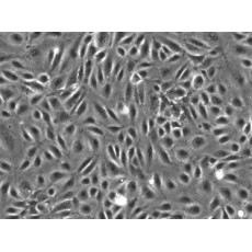 Human Hepatic Sinusoidal Endothelial Cells (HHSEC, Adult)